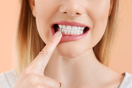 Seals Family Dentistry | Periodontal Treatment, Botox reg  and Dental Sealants